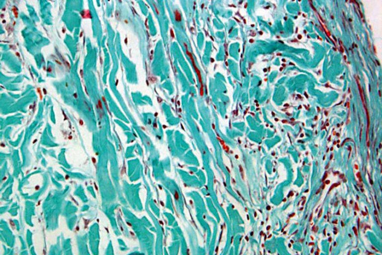 collprotect_membrane_histo