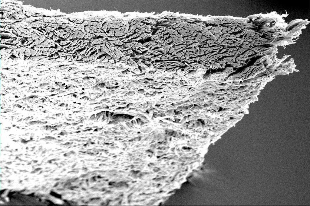 collprotect_membrane_sem