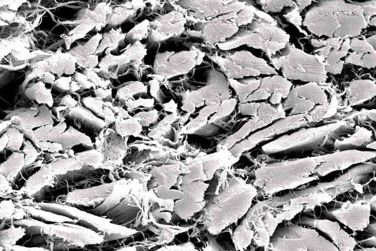 collprotect_membrane_sem2