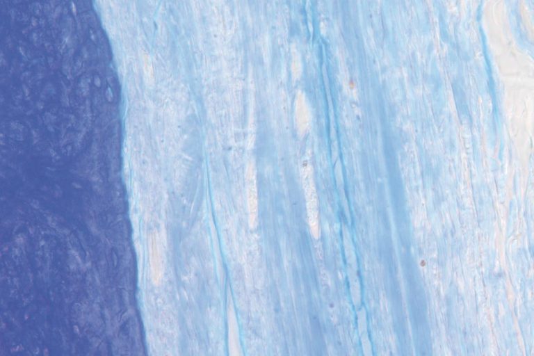 jason_membrane_histo